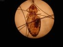 Фотографии к статье: Клещи и блохи (Ticks and fleas) / Советы по уходу и воспитанию породы кошек, описание кошки, помощь при болезнях, фотографии, дискусии и форум.